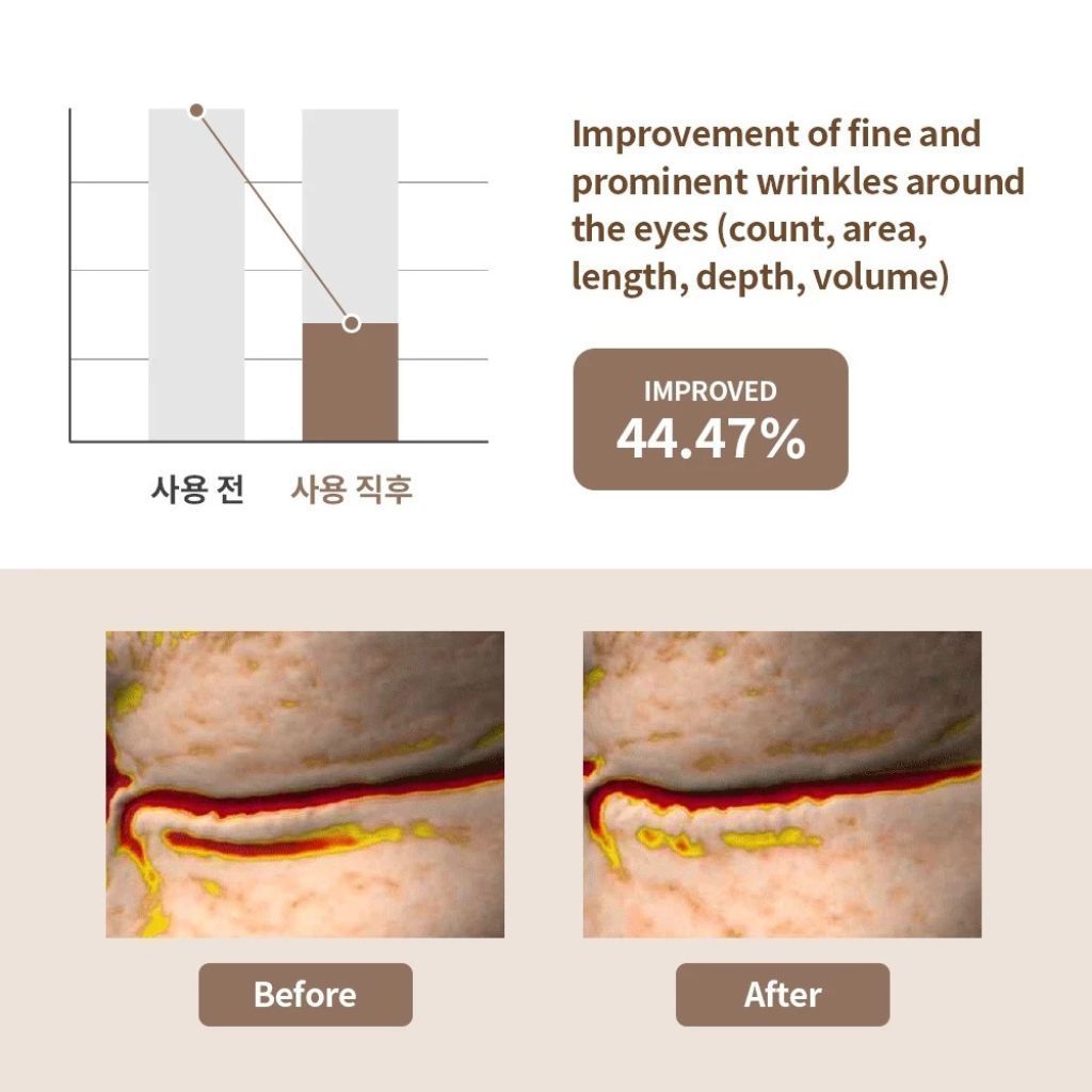  Nạ mắt chống lão hóa Mediheal Retinol Collagen 