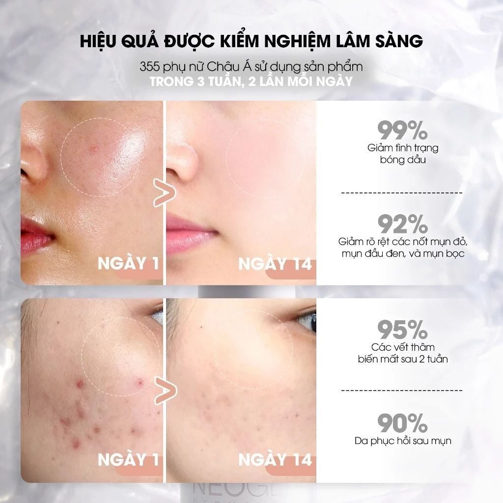 Serum 15% Niacinamide Neogen Kiềm Dầu, Giảm Mụn 30ml 