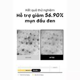  Sáp Tẩy Trang Tfit Deep Clear Cleansing Balm 80g 