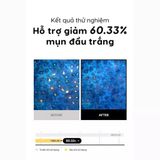  Sáp Tẩy Trang Tfit Deep Clear Cleansing Balm 80g 