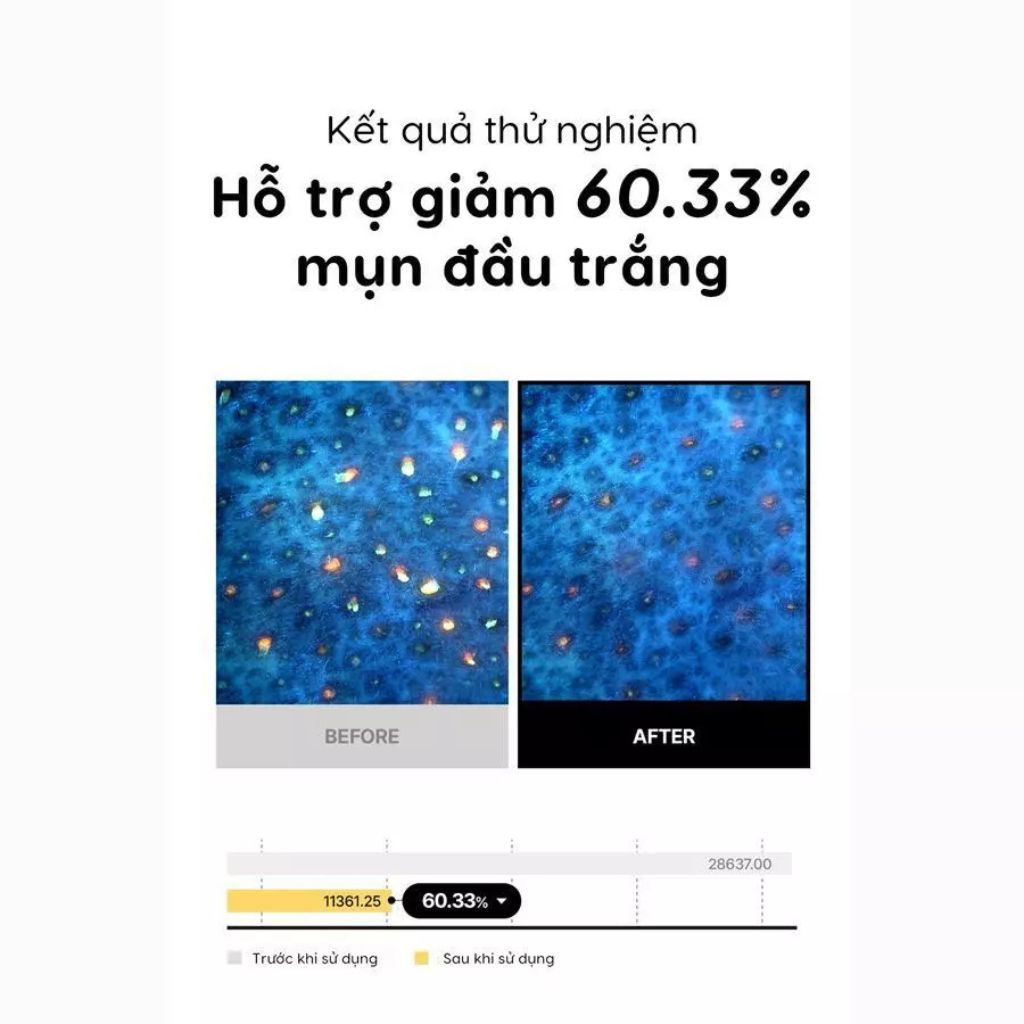  Sáp Tẩy Trang Tfit Deep Clear Cleansing Balm 80g 