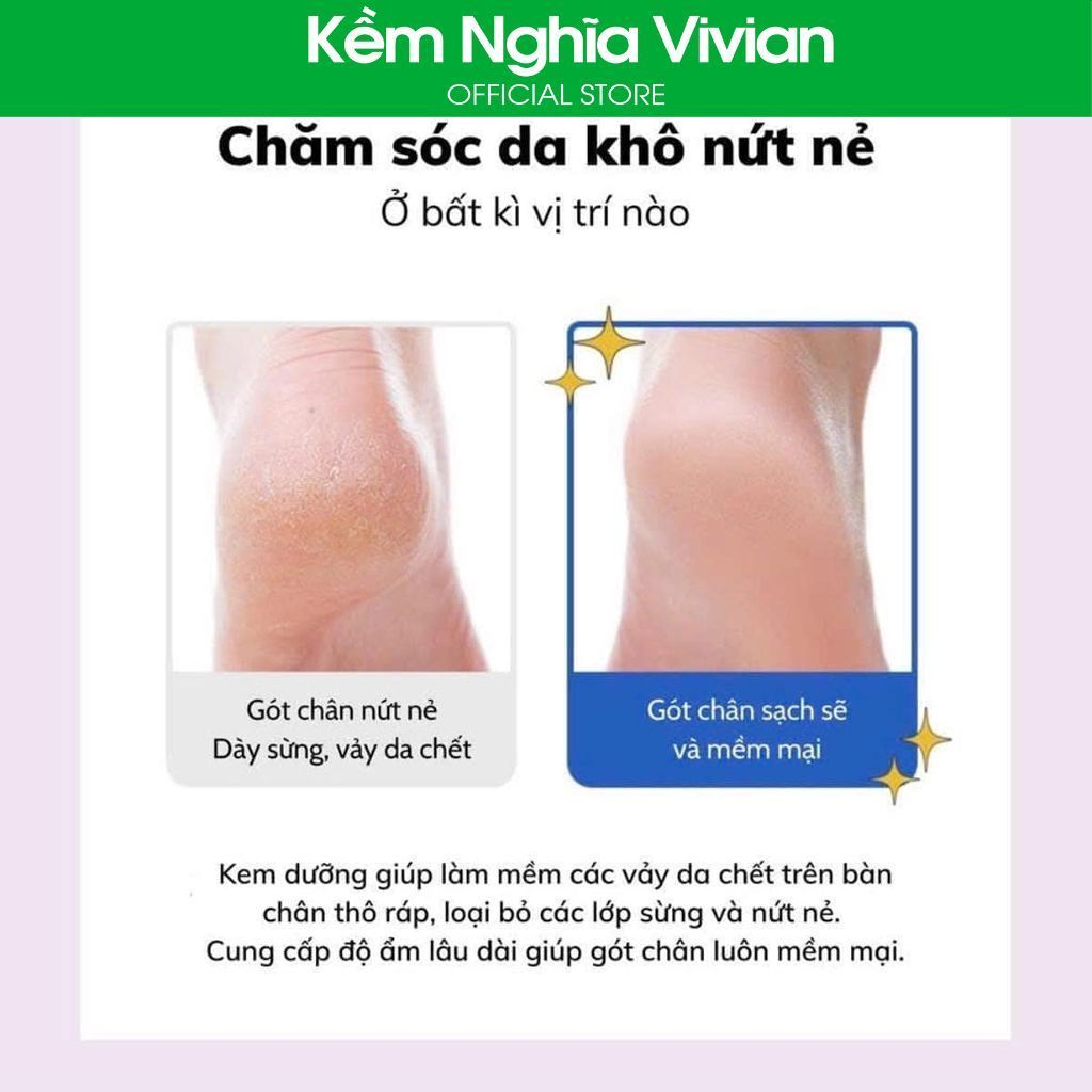  Kem Dưỡng Da Chân Vaseline Deep Moisture Foot Cream 60ml 