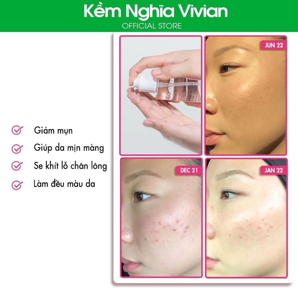  Toner Hỗ Trợ Giảm Mụn Neogen Dermalogy Treatment Acid 5% 150ml 