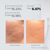  Tinh Chất AHA Se Khít Lỗ Chân Lông CNP 50ml 