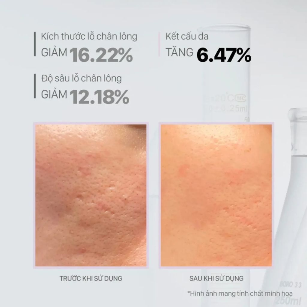  Tinh Chất AHA Se Khít Lỗ Chân Lông CNP 50ml 