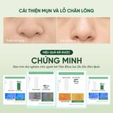  Mặt nạ sữa rửa mặt 2in 1 làm sạch sâu cho da mụn, nhạy cảm Dewdap 150ml 