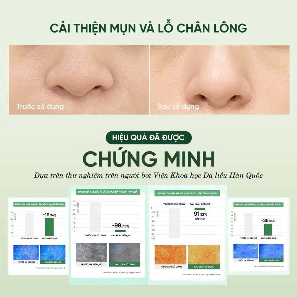  Mặt nạ sữa rửa mặt 2in 1 làm sạch sâu cho da mụn, nhạy cảm Dewdap 150ml 