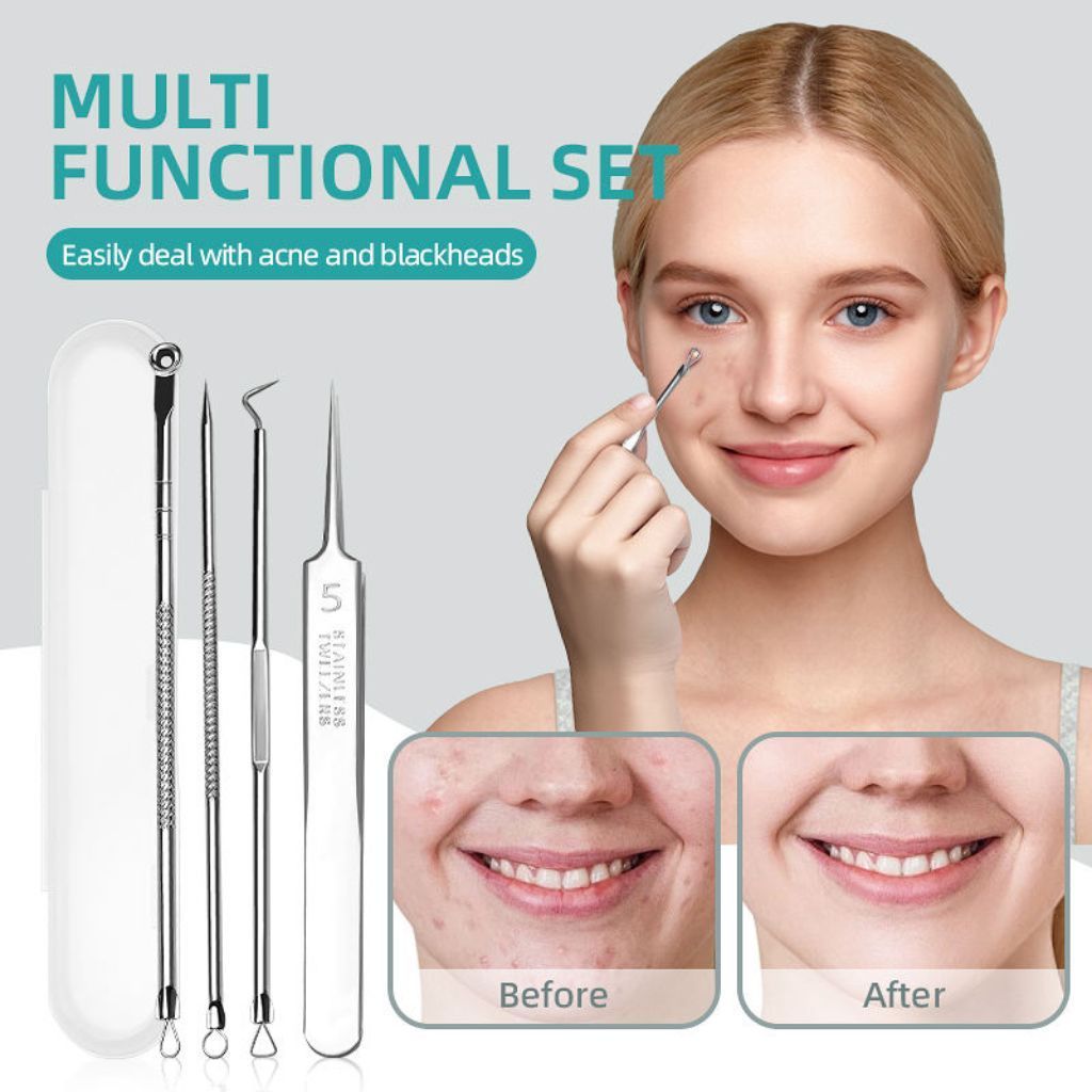  Bộ Nặn Mụn Cá Nhân 