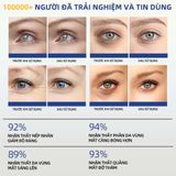  Mặt Nạ Mắt DIKIKI Giảm Quầng Thâm Mắt Mờ Nếp Nhăn Chống Lão Hóa Làm Sáng Da Dưỡng Ẩm Sâu 