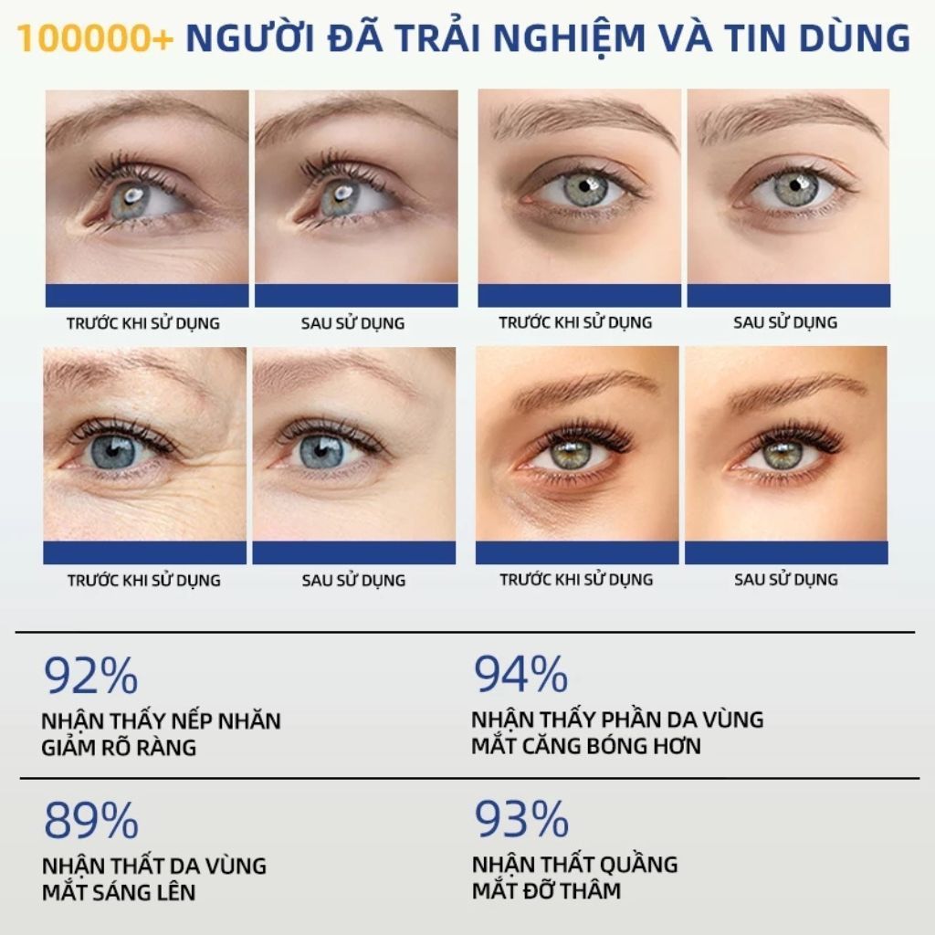  Mặt Nạ Mắt DIKIKI Giảm Quầng Thâm Mắt Mờ Nếp Nhăn Chống Lão Hóa Làm Sáng Da Dưỡng Ẩm Sâu 