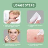  Bộ Nặn Mụn Cá Nhân 