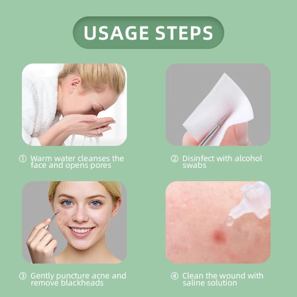  Bộ Nặn Mụn Cá Nhân 