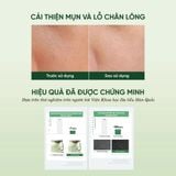  Toner tẩy tế bào chết phức hợp AHA+BHA+PHA cấp ẩm dịu da Dewdap 350ml 