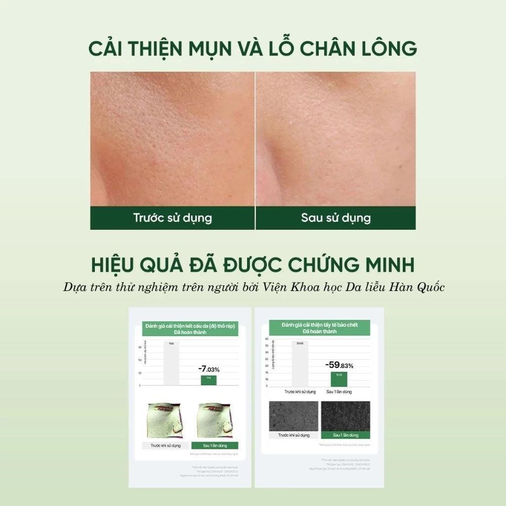  Toner tẩy tế bào chết phức hợp AHA+BHA+PHA cấp ẩm dịu da Dewdap 350ml 