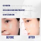  Mặt Nạ Dưỡng Da Sur.Medic+ 