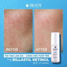 RILASTIL MULTIREPAIR RETINOL TECH RENEWING SERUM ANTI-WRINKLE SMOOTHING - SERUM RETINOL TÁI TẠO VÀ CHỐNG LÃO HÓA