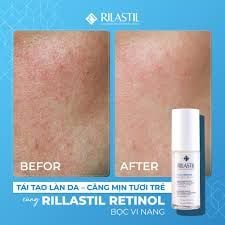 RILASTIL MULTIREPAIR RETINOL TECH RENEWING SERUM ANTI-WRINKLE SMOOTHING - SERUM RETINOL TÁI TẠO VÀ CHỐNG LÃO HÓA