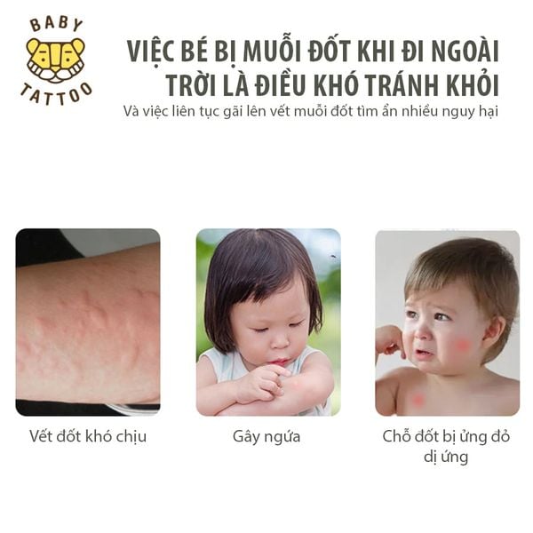  Kem Thoa, Kem Bôi Dịu Da Chăm Sóc Và Làm Dịu Vết Mẩn Ngứa, Muỗi Đốt, Côn Trùng Cắn, Hộp 10 gram 