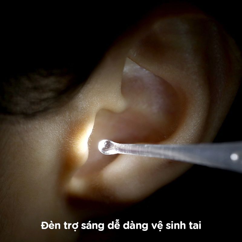 Dụng cụ ngoáy tai sạc kèm kính lúp FSLDZ-515