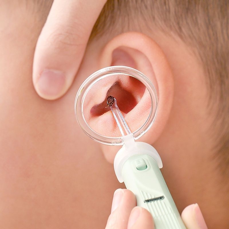 Dụng cụ ngoáy tai sạc kèm kính lúp FSLDZ-515