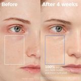  Tinh Chất Aestura Atobarrier 365 Hydro Cera-HA Ampoule 7ml 