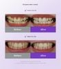  Set Kem Đánh Răng Euthymol Purple Whitening Toothpaste 106g + Tuýp Mini 30g + 3 Gói Nước Súc Miệng 