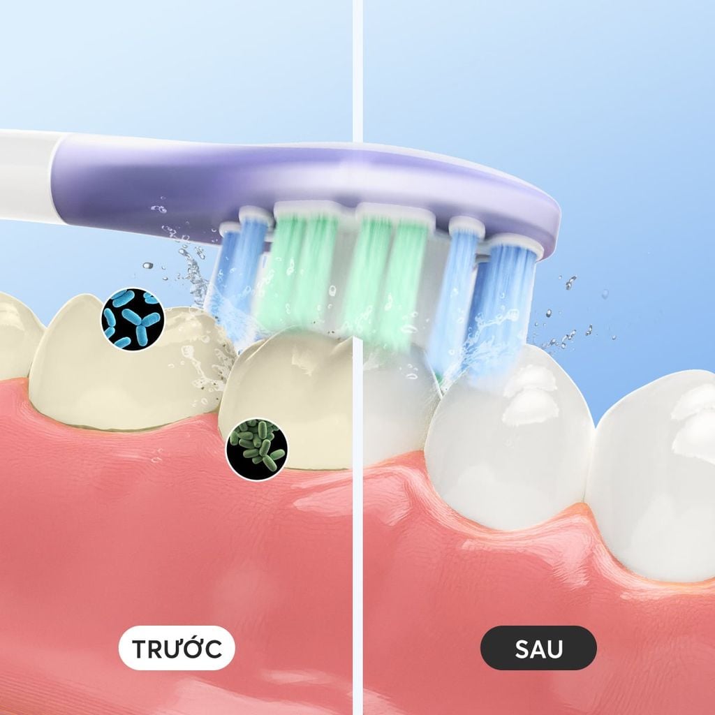 Bàn Chải Điện Cao Cấp Mifan Vibrosonic X9