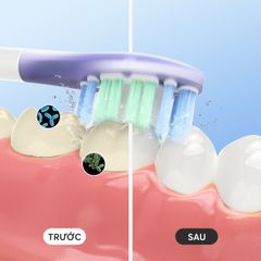 Bàn Chải Điện Cao Cấp Mifan Vibrosonic X9