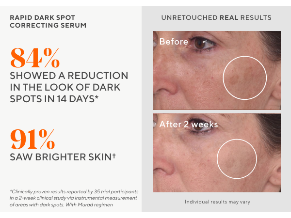 SERUM MURAD DARK SPOT GIẢM NÁM SÁNG DA MẪU MỚI 10ML