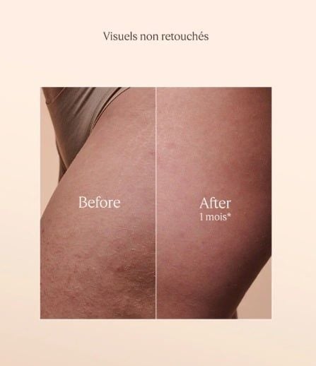 DẦU DƯỠNG HẠNH NHÂN L'OCCITANE ALMOND SUPPLE SKIN OIL 100ML