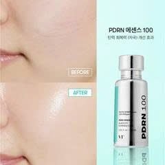 Tinh chất VT PDRN ESSENCE 100 (SET 30ML + 30ML + VI KIM 10ML)
