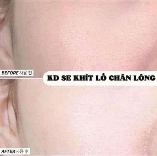 Kem dưỡng Bioderma Sebium Hydra 40ml