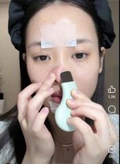 THANH ĐẨY MỤN ILSO HÀN QUỐC