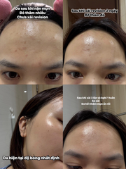 Kem Dưỡng Da Revision D.E.J Night Face Cream 0,25 Retinol and Bakuchiol