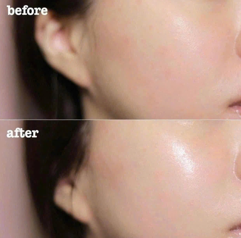 KEM DƯỠNG SÁNG DA VÀ PHỤC HỒI SAU MỤN DR.ALTHEA 345 NA RELIEF CREACN 50ML