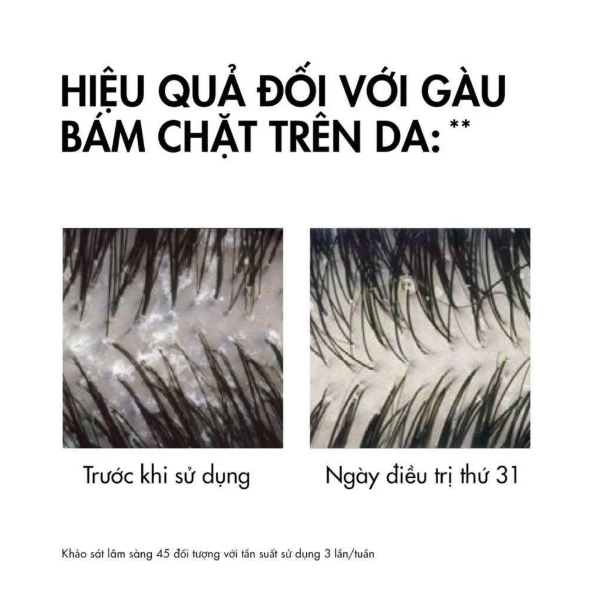 DẦU GỘI GIẢM GÀU CHO DA ĐẦU, DẦU, NGỨA VICHY DERCOS SHAMPOO 50ML
