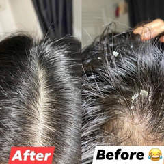 DẦU GỘI GIẢM GÀU CHO DA ĐẦU, DẦU, NGỨA VICHY DERCOS SHAMPOO 50ML