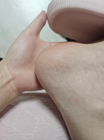 KEM DƯỠNG DA CHÂN DAISO 100ML UREA