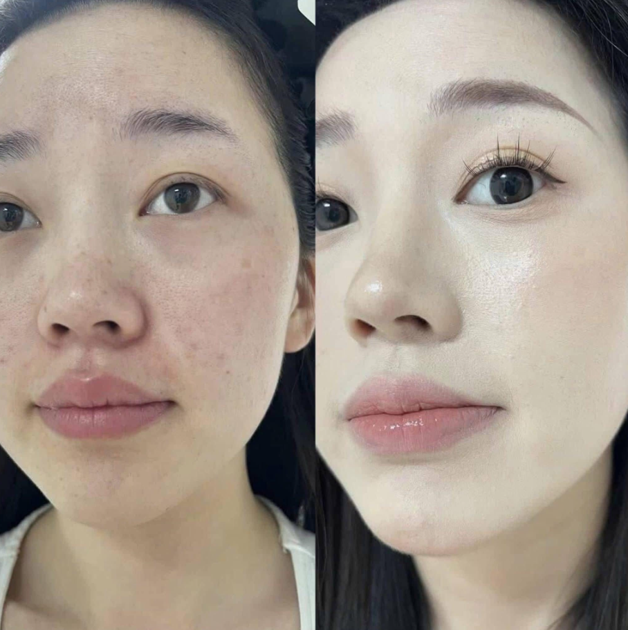 CUSHION RENODERM DAY LONG BB CREAM