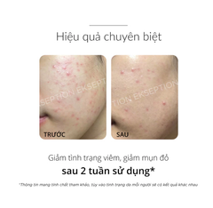 TINH CHẤT SÁNG DA, GIẢM MỤN SERUM KẼM ZnPCA ESKEPTION 75ML