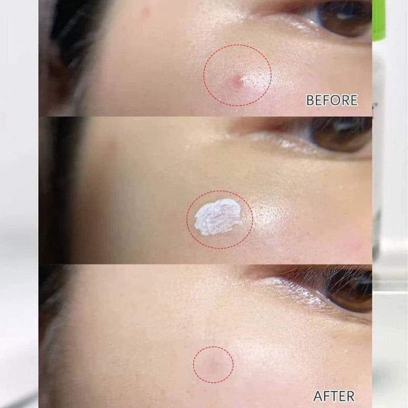 DUNG DỊCH CHẤM MỤN DR.JART+ TEATREEMENT SOOTHING SPOT 15ML