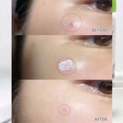 DUNG DỊCH CHẤM MỤN DR.JART+ TEATREEMENT SOOTHING SPOT 15ML