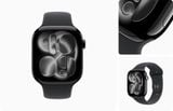  Apple Watch Series 11 46mm Aluminum 