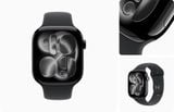  Apple Watch Series 11 42mm Aluminum 