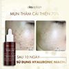 Tinh Chất Kiểm Soát Dầu Thừa, Mờ Thâm Và Hỗ Trợ Giảm Mụn Ekseption Hyaluronic Niacin Mixlab Serum 75ml