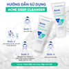 Gel rửa mặt Trioderma Acne Deep Cleanser 150ml