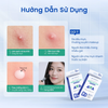 Miếng dán mụn TRIODERMA (hộp 18 miếng)