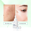 Tinh chất Bioverse B351 Acne Clear up Serum