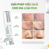 Gel chăm sóc mụn Daily Effect Acne Spot Control Gel