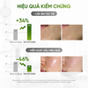 Serum phục hồi giảm mụn Daily Effect Phytosome Pore Refining Serum 15g